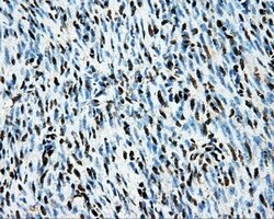 LOX Mouse anti-Human, Clone: OTI9G6, liquid, TrueMAB 100 &mu;L; Unconjugated:Antibodies,