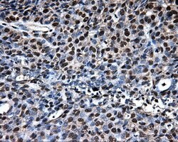 LOX Mouse anti-Human, Clone: OTI9G6, liquid, TrueMAB 100 &mu;L; Unconjugated:Antibodies,