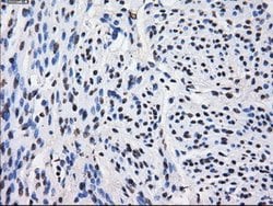 LOX Mouse anti-Human, Clone: OTI9A11, lyophilized, TrueMAB 100 &mu;g; Unconjugated:Antibodies,