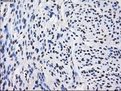 LOX Mouse anti-Human, Clone: OTI9A11, liquid, TrueMAB 100 &mu;L; Unconjugated:Antibodies,