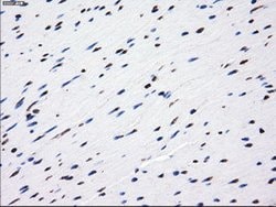 LOX Mouse anti-Human, Clone: OTI9A11, lyophilized, TrueMAB 100 &mu;g; Unconjugated:Antibodies,