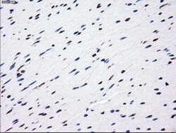 LOX Mouse anti-Human, Clone: OTI9A11, liquid, TrueMAB 100 &mu;L; Unconjugated:Antibodies,