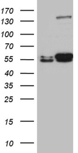 LOX Mouse anti-Human, Clone: OTI9B5, lyophilized, TrueMAB 100 &mu;g; Unconjugated:Antibodies,