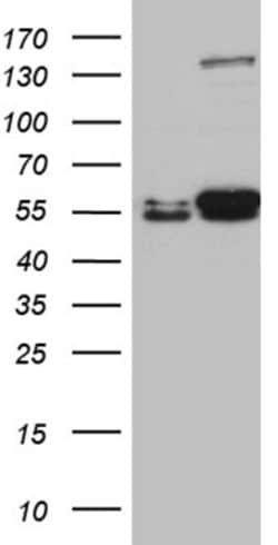 LOX Mouse anti-Human, Clone: OTI9B5, liquid, TrueMAB 100 &mu;L; Unconjugated:Antibodies,