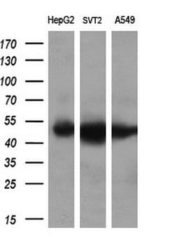 LOX Mouse anti-Human, Clone: OTI9B5, liquid, TrueMAB 100 &mu;L; Unconjugated:Antibodies,