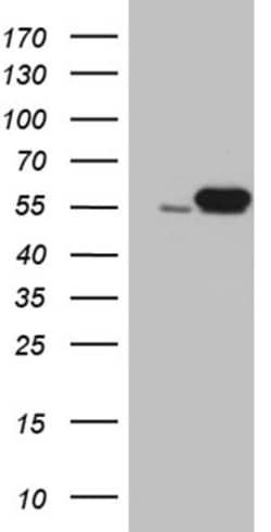 LOX Monoclonal Antibody (OTI7E6), TrueMAB , OriGene:Antibodies:Primary