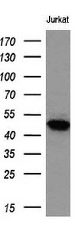 LOX Mouse anti-Human, Clone: OTI6B7, liquid, TrueMAB 100 &mu;L; Unconjugated:Antibodies,