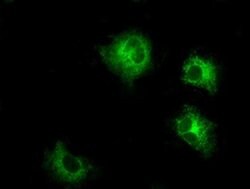 LOX Mouse anti-Human, Clone: OTI9G6, liquid, TrueMAB 100 &mu;L; Unconjugated:Antibodies,