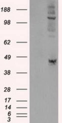 LOX Mouse anti-Human, Clone: OTI9A11, lyophilized, TrueMAB 100 &mu;g; Unconjugated:Antibodies,