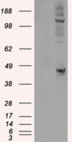 LOX Mouse anti-Human, Clone: OTI9A11, liquid, TrueMAB 100 &mu;L; Unconjugated:Antibodies,