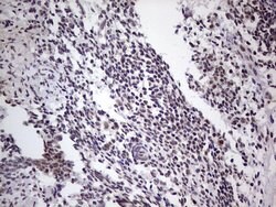 LPIN1 Monoclonal Antibody (OTI1B7), TrueMAB , OriGene 100 &mu;L; Unconjugated:Antibodies,