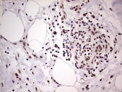 LPIN1 Monoclonal Antibody (OTI1B7), TrueMAB , OriGene 100 &mu;L; Unconjugated:Antibodies,