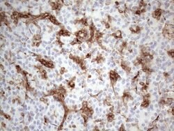 LPIN1 Monoclonal Antibody (OTI7F5), TrueMAB , OriGene 100 &mu;L; Unconjugated:Antibodies,