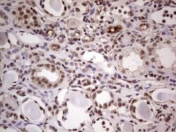 LPIN1 Monoclonal Antibody (OTI2H6), TrueMAB , OriGene 100 &mu;L; Unconjugated:Antibodies,