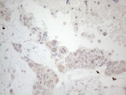 LPIN1 Monoclonal Antibody (OTI1B2), TrueMAB , OriGene 100 &mu;L; Unconjugated:Antibodies,