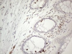 LPIN1 Monoclonal Antibody (OTI1B2), TrueMAB , OriGene 100 &mu;L; Unconjugated:Antibodies,