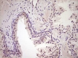 LPIN1 Monoclonal Antibody (OTI7H6), TrueMAB , OriGene 100 &mu;L; Unconjugated:Antibodies,