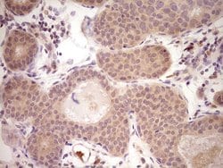 LPIN1 Monoclonal Antibody (OTI7H6), TrueMAB , OriGene 100 &mu;L; Unconjugated:Antibodies,