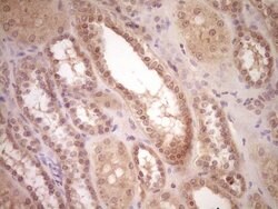 LPIN1 Monoclonal Antibody (OTI7H6), TrueMAB , OriGene 100 &mu;L; Unconjugated:Antibodies,