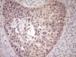 LPIN1 Monoclonal Antibody (OTI7H6), TrueMAB , OriGene:Antibodies:Primary