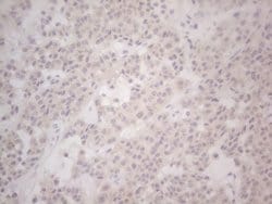 LPIN1 Monoclonal Antibody (OTI5B5), TrueMAB , OriGene 100 &mu;L; Unconjugated:Antibodies,