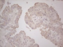 LPIN1 Monoclonal Antibody (OTI5B5), TrueMAB , OriGene 100 &mu;L; Unconjugated:Antibodies,