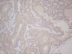 LPIN1 Monoclonal Antibody (OTI5B5), TrueMAB , OriGene 100 &mu;L; Unconjugated:Antibodies,