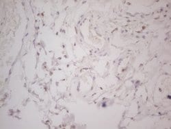 LPIN1 Monoclonal Antibody (OTI5B5), TrueMAB , OriGene 100 &mu;L; Unconjugated:Antibodies,
