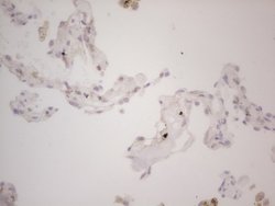 LPIN1 Monoclonal Antibody (OTI5B5), TrueMAB , OriGene 100 &mu;L; Unconjugated:Antibodies,