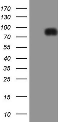 LPIN1 Monoclonal Antibody (OTI7F5), TrueMAB , OriGene 100 &mu;L; Unconjugated:Antibodies,