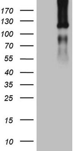 LPIN1 Monoclonal Antibody (OTI1B2), TrueMAB , OriGene 100 &mu;L; Unconjugated:Antibodies,