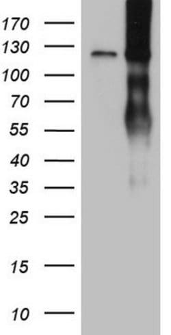LPIN1 Monoclonal Antibody (OTI2C8), TrueMAB , OriGene 100 &mu;L; Unconjugated:Anticuerpos