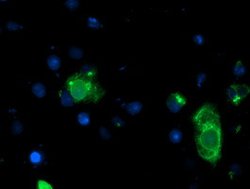 LPL Mouse anti-Human, Clone: OTI6A10, lyophilized, TrueMAB 100 &mu;g; Unconjugated:Antibodies,