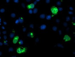 LPL Monoclonal Antibody (OTI4F6), TrueMAB , OriGene 100 &mu;L; Unconjugated:Antibodies,