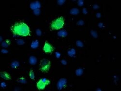 LPL Mouse anti-Human, Clone: OTI4G7, lyophilized, TrueMAB 100 &mu;g; Unconjugated:Antibodies,