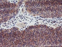 LPL Mouse anti-Human, Clone: OTI3C8, lyophilized, TrueMAB 100 &mu;g; Unconjugated:Antibodies,