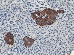 LPL Monoclonal Antibody (OTI4H3), TrueMAB , OriGene 100 &mu;L; Unconjugated:Antibodies,