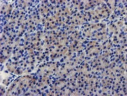 LPL Mouse anti-Human, Clone: OTI6A10, lyophilized, TrueMAB 100 &mu;g; Unconjugated:Antibodies,