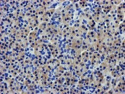 LPL Monoclonal Antibody (OTI4F6), TrueMAB , OriGene 100 &mu;L; Unconjugated:Antibodies,