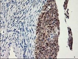 LPL Monoclonal Antibody (OTI3A10), TrueMAB , OriGene 100 &mu;L; Unconjugated:Antibodies,