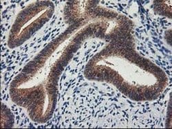 LPL Monoclonal Antibody (OTI3A10), TrueMAB , OriGene 100 &mu;L; Unconjugated:Antibodies,