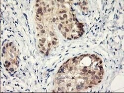 LPL Monoclonal Antibody (OTI3A10), TrueMAB , OriGene 100 &mu;L; Unconjugated:Antibodies,