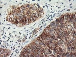 LPL Monoclonal Antibody (OTI3A10), TrueMAB , OriGene 100 &mu;L; Unconjugated:Antibodies,