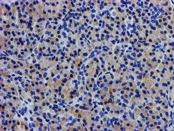 LPL Mouse anti-Human, Clone: OTI4G7, lyophilized, TrueMAB 100 &mu;g; Unconjugated:Antibodies,