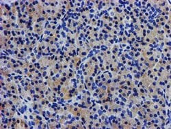 LPL Monoclonal Antibody (OTI4G7), TrueMAB , OriGene 100 &mu;L; Unconjugated:Antibodies,