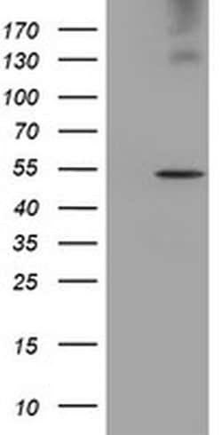 LPL Monoclonal Antibody (OTI2C12), TrueMAB , OriGene:Antibodies:Primary
