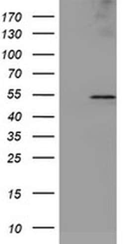 LPL Monoclonal Antibody (OTI6B4), TrueMAB , OriGene 100 &mu;L; Unconjugated:Antibodies,