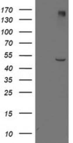 LPL Mouse anti-Human, Clone: OTI3C8, lyophilized, TrueMAB 100 &mu;g; Unconjugated:Antibodies,