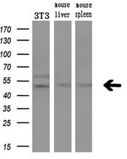 LPL Mouse anti-Human, Clone: OTI3C8, lyophilized, TrueMAB 100 &mu;g; Unconjugated:Antibodies,