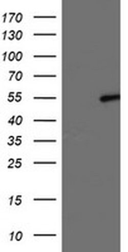 LPL Monoclonal Antibody (OTI4H3), TrueMAB , OriGene 100 &mu;L; Unconjugated:Antibodies,
